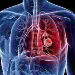 �S���_�\1002�� 337���h�T�ɲ�����؟