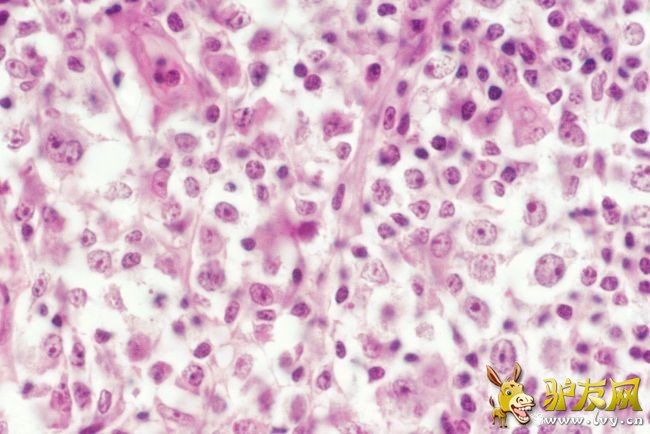 �ǻ�����ܰ���